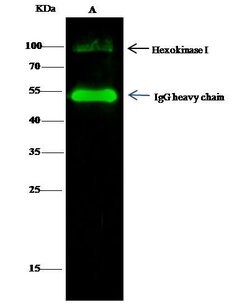 Invitrogen HK1 Polyclonal Antibody 100 &mu;L | Buy Online | Invitrogen&trade; | Fisher Scientific