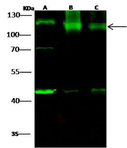 Invitrogen HK1 Polyclonal Antibody 100 &mu;L | Buy Online | Invitrogen&trade; | Fisher Scientific