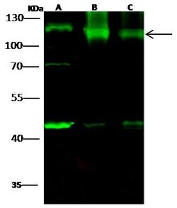 Invitrogen HK1 Polyclonal Antibody 100 &mu;L | Buy Online | Invitrogen&trade; | Fisher Scientific