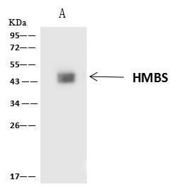 Invitrogen HMBS Polyclonal Antibody 100 &mu;L; Unconjugated:Antibodies,