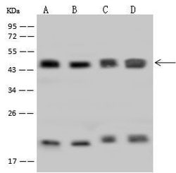 Invitrogen HMBS Polyclonal Antibody 100 &mu;L; Unconjugated:Antibodies,