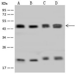 Invitrogen HMBS Polyclonal Antibody 100 &mu;L; Unconjugated:Antibodies,