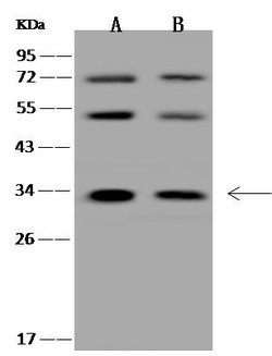 Invitrogen HYLS1 Polyclonal Antibody 100 &mu;L; Unconjugated:Antibodies,