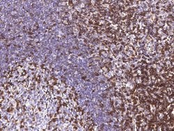 Invitrogen IFITM1 Polyclonal Antibody 100 &mu;L; Unconjugated:Antibodies,