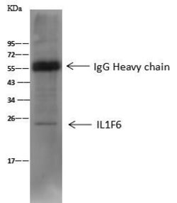 Invitrogen IL1F6 Polyclonal Antibody 100 μL; Unconjugated:Antibodies,