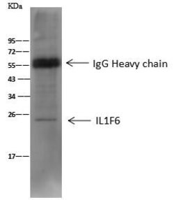 Invitrogen IL1F6 Polyclonal Antibody 100 μL; Unconjugated:Antibodies,
