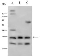 Invitrogen IL1F6 Polyclonal Antibody 100 μL; Unconjugated:Antibodies,
