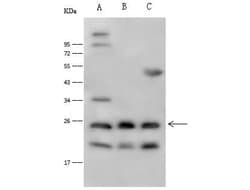 Invitrogen IL1F6 Polyclonal Antibody 100 μL; Unconjugated:Antibodies,