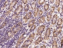 Invitrogen IMPA1 Polyclonal Antibody 100 &mu;L; Unconjugated:Antibodies,