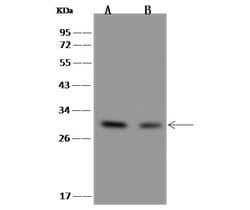 Invitrogen IMPA1 Polyclonal Antibody 100 &mu;L; Unconjugated:Antibodies,