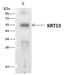 Invitrogen Cytokeratin 13 Polyclonal Antibody 100 &mu;L | Buy Online | Invitrogen&trade; | Fisher Scientific