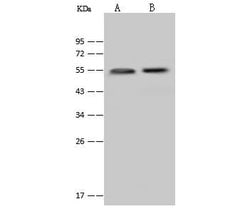 Invitrogen Cytokeratin 13 Polyclonal Antibody 100 &mu;L | Buy Online | Invitrogen&trade; | Fisher Scientific