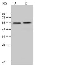 Invitrogen Cytokeratin 13 Polyclonal Antibody 100 &mu;L | Buy Online | Invitrogen&trade; | Fisher Scientific