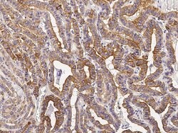 Invitrogen Cytokeratin 19 Polyclonal Antibody 100 &mu;L; Unconjugated:Antibodies,