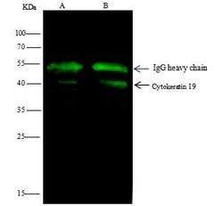 Invitrogen Cytokeratin 19 Polyclonal Antibody 100 &mu;L; Unconjugated:Antibodies,