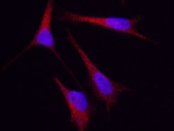 Invitrogen Cytokeratin 5 Polyclonal Antibody 100 &mu;L; Unconjugated:Antibodies,