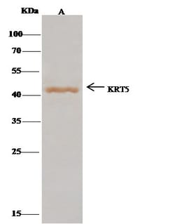 Invitrogen Cytokeratin 5 Polyclonal Antibody 100 &mu;L; Unconjugated:Antibodies,