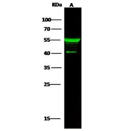 Invitrogen Cytokeratin 5 Polyclonal Antibody 100 &mu;L; Unconjugated:Antibodies,