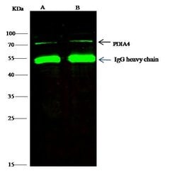 Invitrogen Cytokeratin 5 Polyclonal Antibody 100 &mu;L; Unconjugated:Antibodies,