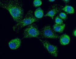 Invitrogen LAMP2 Polyclonal Antibody 100 &mu;L; Unconjugated:Antibodies,
