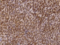 Invitrogen LAMP2 Polyclonal Antibody 100 &mu;L; Unconjugated:Antibodies,