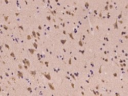 Invitrogen LIAS Polyclonal Antibody 100 &mu;L | Buy Online | Invitrogen&trade; | Fisher Scientific