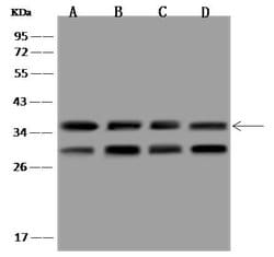 Invitrogen LRRC59 Polyclonal Antibody 100 &mu;L; Unconjugated:Antibodies,