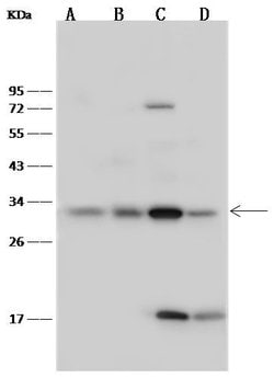 Invitrogen Latexin Polyclonal Antibody 100 &mu;L | Buy Online | Invitrogen&trade; | Fisher Scientific