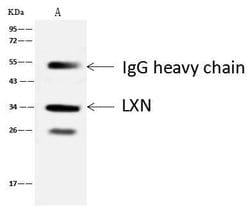 Invitrogen Latexin Polyclonal Antibody 100 &mu;L | Buy Online | Invitrogen&trade; | Fisher Scientific