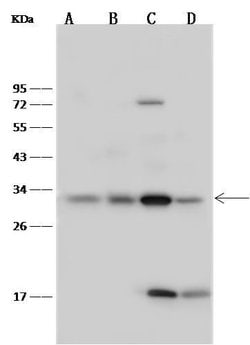Invitrogen Latexin Polyclonal Antibody 100 &mu;L | Buy Online | Invitrogen&trade; | Fisher Scientific