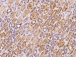 Invitrogen LYPLAL1 Polyclonal Antibody 100 &mu;L; Unconjugated:Antibodies,