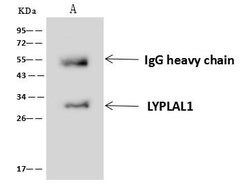Invitrogen LYPLAL1 Polyclonal Antibody 100 &mu;L; Unconjugated:Antibodies,