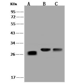 Invitrogen LYPLAL1 Polyclonal Antibody 100 &mu;L; Unconjugated:Antibodies,