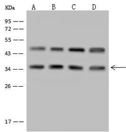 Invitrogen LZTFL1 Polyclonal Antibody 100 &mu;L; Unconjugated:Antibodies,