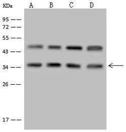 Invitrogen LZTFL1 Polyclonal Antibody 100 &mu;L; Unconjugated:Antibodies,