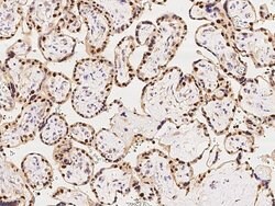 Invitrogen MAGEA10 Polyclonal Antibody 100 &mu;L; Unconjugated:Antibodies,