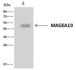 Invitrogen MAGEA10 Polyclonal Antibody 100 &mu;L; Unconjugated:Antibodies,