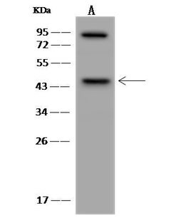 Invitrogen MAGEA10 Polyclonal Antibody 100 &mu;L; Unconjugated:Antibodies,