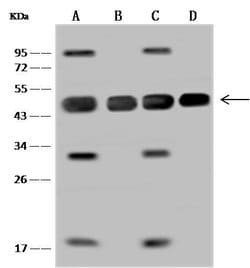 Invitrogen MEK2 Polyclonal Antibody 100 &mu;L; Unconjugated:Antibodies,