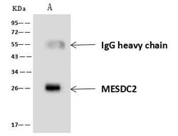 Invitrogen MESDC2 Polyclonal Antibody 100 &mu;L | Buy Online | Invitrogen&trade; | Fisher Scientific