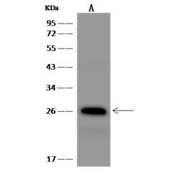 Invitrogen MESDC2 Polyclonal Antibody 100 &mu;L | Buy Online | Invitrogen&trade; | Fisher Scientific