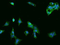 MFN2 Polyclonal Antibody:Antibodies, Polyclonal
