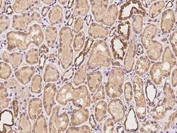 MFN2 Polyclonal Antibody:Antibodies, Polyclonal