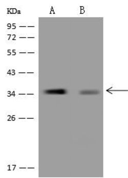 Invitrogen C20orf72 Polyclonal Antibody 100 &mu;L; Unconjugated:Antibodies,