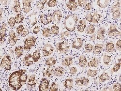 Invitrogen MLPH Polyclonal Antibody 100 &mu;L; Unconjugated:Antibodies,