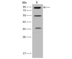 Invitrogen MLPH Polyclonal Antibody 100 &mu;L; Unconjugated:Antibodies,