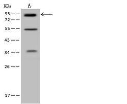 Invitrogen MLPH Polyclonal Antibody 100 &mu;L; Unconjugated:Antibodies,