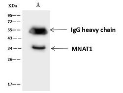 Invitrogen MNAT1 Polyclonal Antibody 100 &mu;L; Unconjugated:Antibodies,