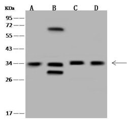 Invitrogen MNAT1 Polyclonal Antibody 100 &mu;L; Unconjugated:Antibodies,