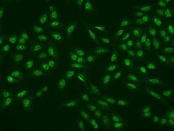 Invitrogen MRI1 Polyclonal Antibody 100 &mu;L; Unconjugated:Antibodies,